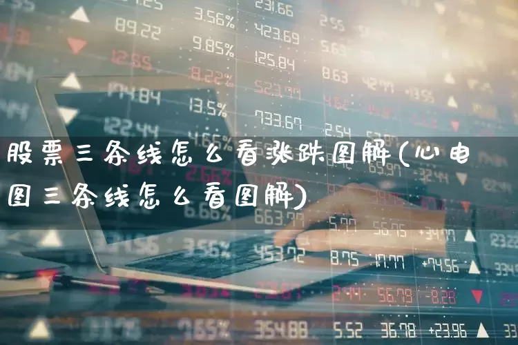 股票三条线怎么看涨跌图解(心电图三条线怎么看图解)_https://www.hhem8.com_创业板_第1张
